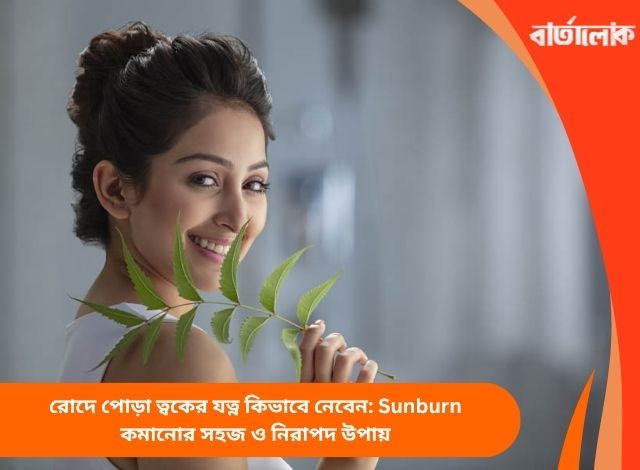 রোদে পোড়া ত্বকের যত্ন কিভাবে নেবেন: Sunburn কমানোর সহজ ও নিরাপদ উপায়