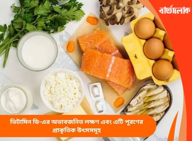 ভিটামিন ডি-এর অভাবজনিত লক্ষণ এবং এটি পূরণের প্রাকৃতিক উৎসসমূহ