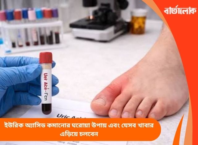 ইউরিক অ্যাসিড কমানোর ঘরোয়া উপায় এবং যেসব খাবার এড়িয়ে চলবেন