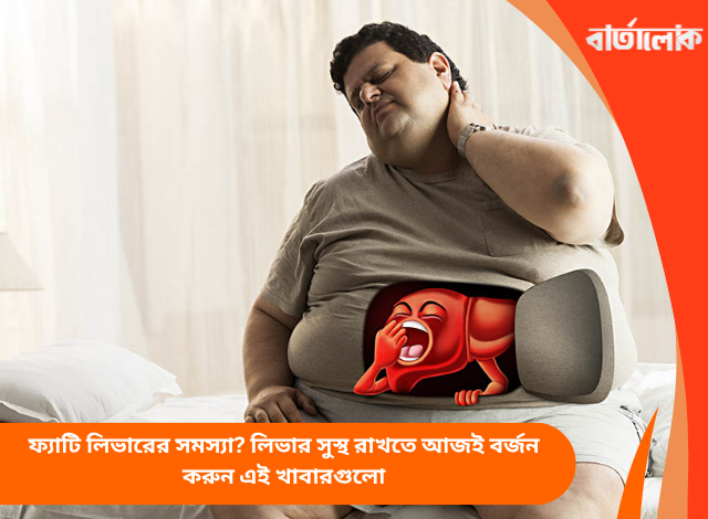 ফ্যাটি লিভারের সমস্যা? লিভার সুস্থ রাখতে আজই বর্জন করুন এই খাবারগুলো