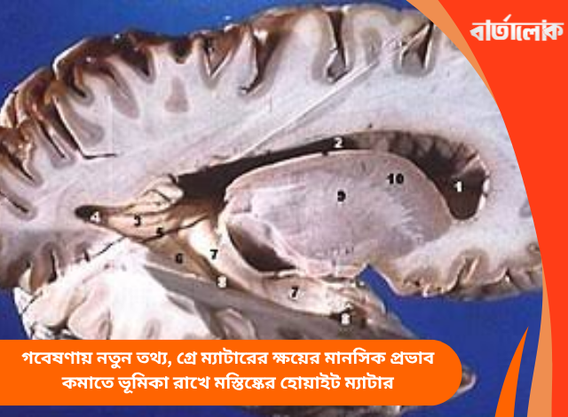 গবেষণায় নতুন তথ্য, গ্রে ম্যাটারের ক্ষয়ের মানসিক প্রভাব কমাতে ভূমিকা রাখে মস্তিষ্কের হোয়াইট ম্যাটার