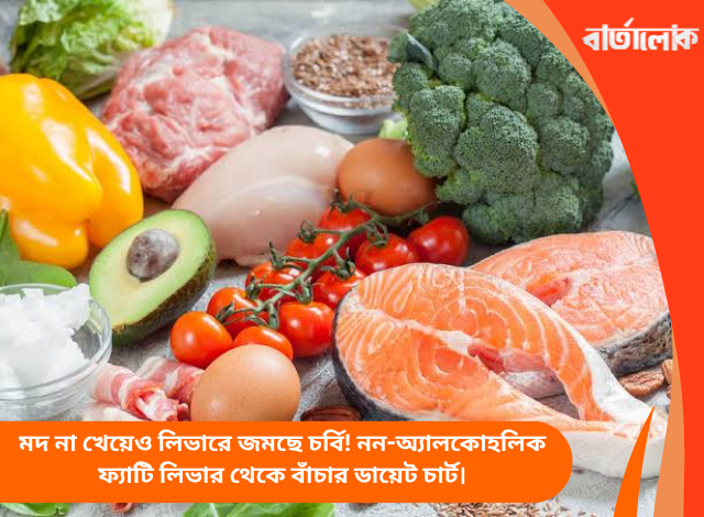 মদ না খেয়েও লিভারে জমছে চর্বি! নন-অ্যালকোহলিক ফ্যাটি লিভার থেকে বাঁচার ডায়েট চার্ট।