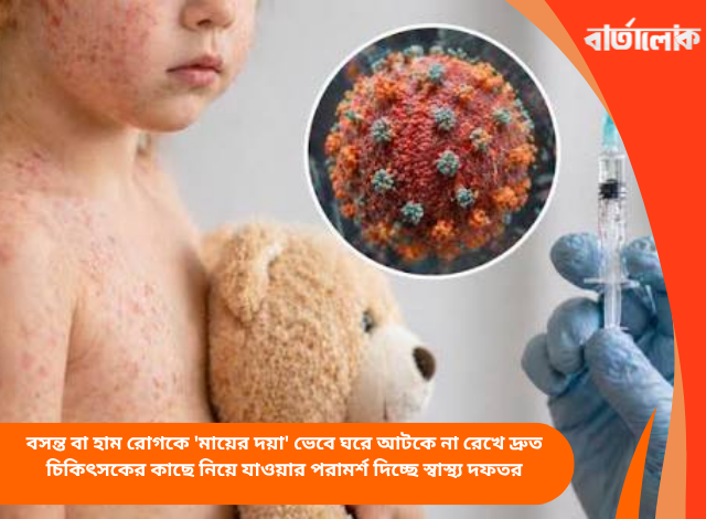 বসন্ত বা হাম রোগকে 'মায়ের দয়া' ভেবে ঘরে আটকে না রেখে দ্রুত চিকিৎসকের কাছে নিয়ে যাওয়ার পরামর্শ দিচ্ছে স্বাস্থ্য দফতর