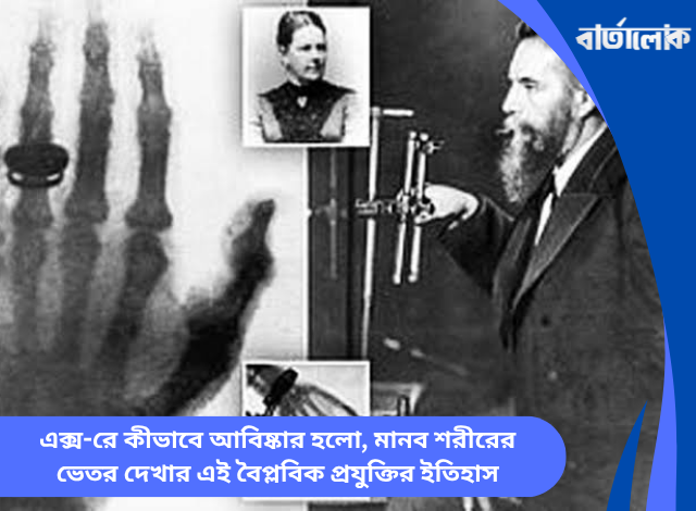 এক্স-রে কীভাবে আবিষ্কার হলো, মানব শরীরের ভেতর দেখার এই বৈপ্লবিক প্রযুক্তির ইতিহাস