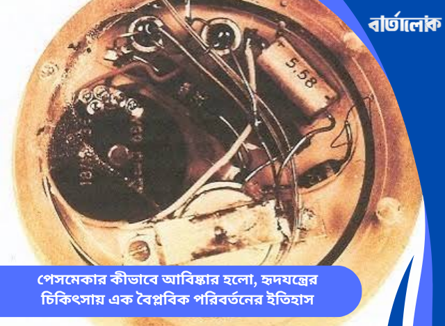 পেসমেকার কীভাবে আবিষ্কার হলো, হৃদযন্ত্রের চিকিৎসায় এক বৈপ্লবিক পরিবর্তনের ইতিহাস